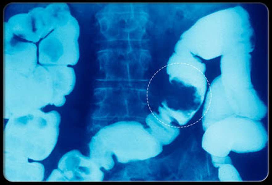 Bất động - Hình ảnh minh họa